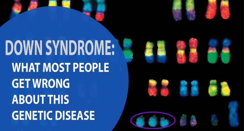 down syndrome what most people get wrong about this genetic disease brain and body chiropractic