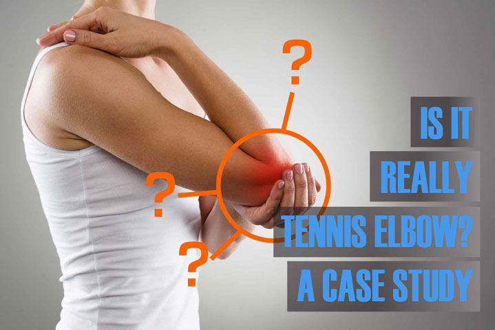 case study chronic elbow pain and nerve entrapment chiropractor in holland